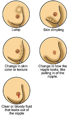 Womens health - Breast Cancer