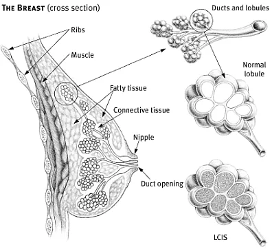 Women's health - Breast Care