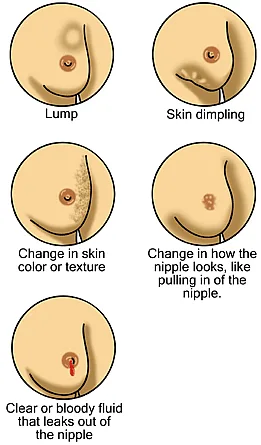 Women's health - Breast Cancer