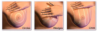 Women's health - Breast Examination