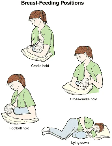 Women's health - Breastfeeding